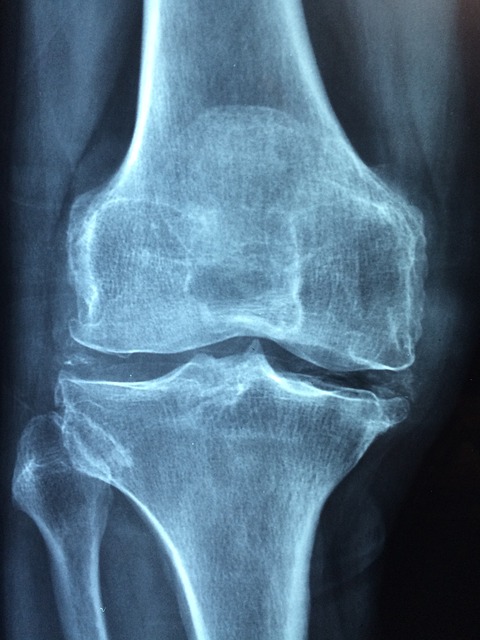knee joint